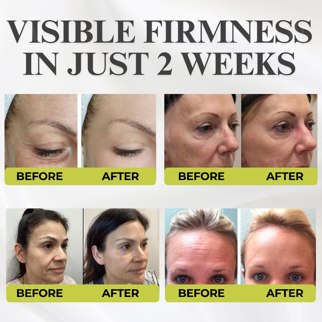 AEXZR® Botox & Vita-A Retinol Shot Wrinkle - Lift Tightening Cream