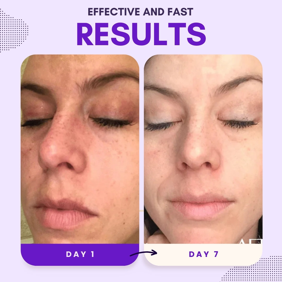 AEXZR® Thiamidol 630 Serum